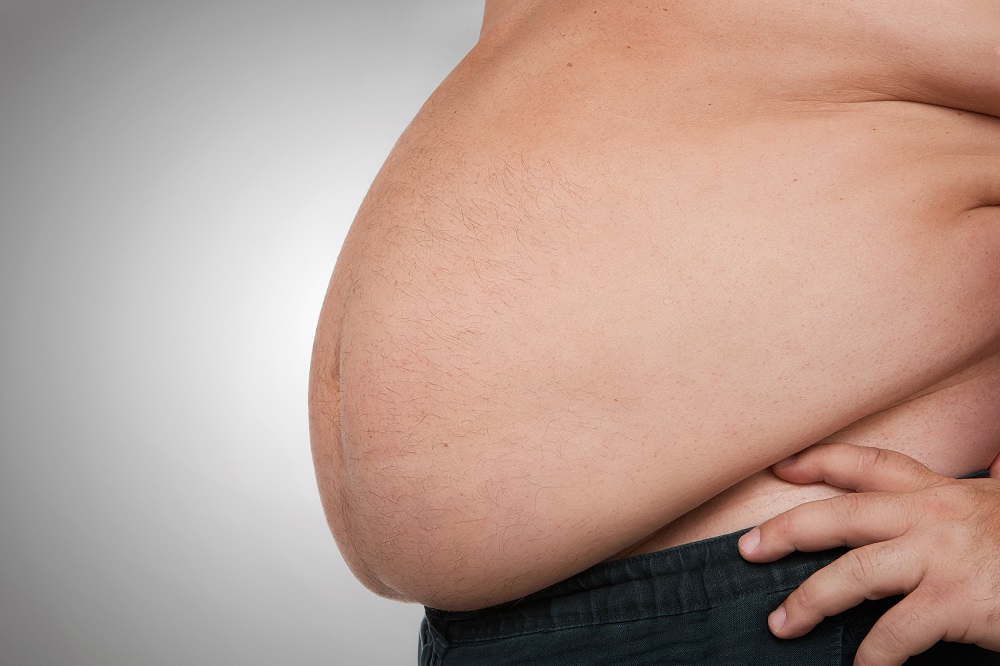 A photo of an obese man's belly, showing what it is like to be a fat man before losing weight